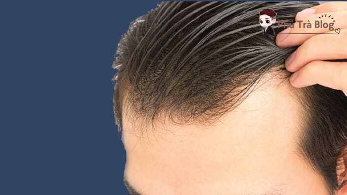 Tình trạng bết và rít tóc khi sử dụng sáp “rep 1:1 tóp tóp”